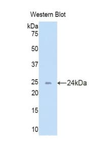 Polyclonal Rabbit anti-Mouse TNFRSF4 / CD134 / OX40 Antibody (aa29-210, WB)