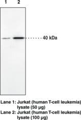 Polyclonal Rabbit anti-Human CNR2 / CB2 Antibody (aa20-33, IHC, WB)