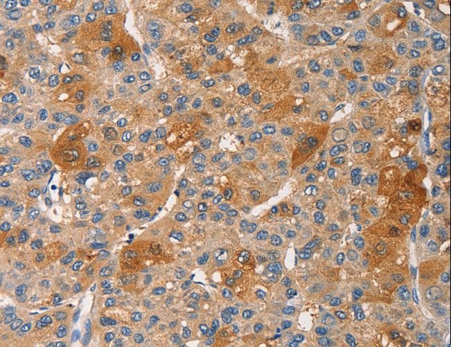 Polyclonal Rabbit anti-Human PRKCE / PKC-Epsilon Antibody (IHC)