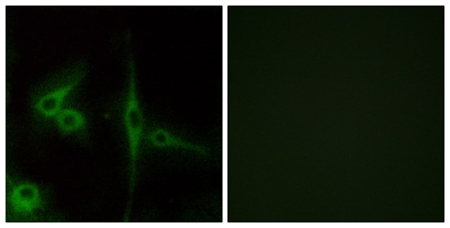 ADGRL4 / ELTD1 Antibody (aa251-300)