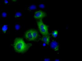 Monoclonal Mouse anti-Human PDE4A / PDE4 Antibody (clone OTI2G2, IHC, IF, WB)