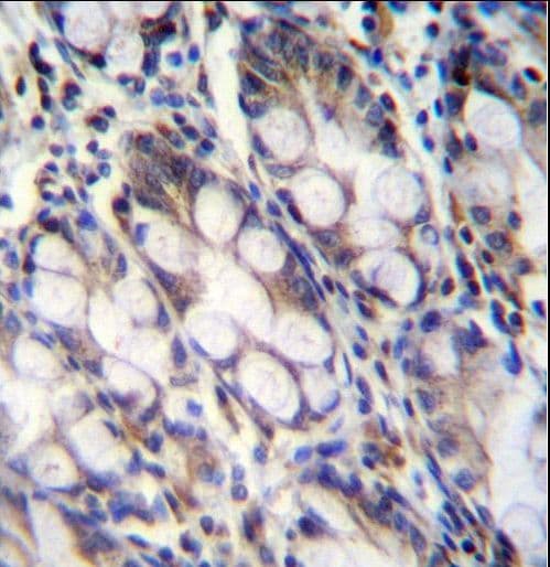 FNDC7 Antibody (aa705-735)