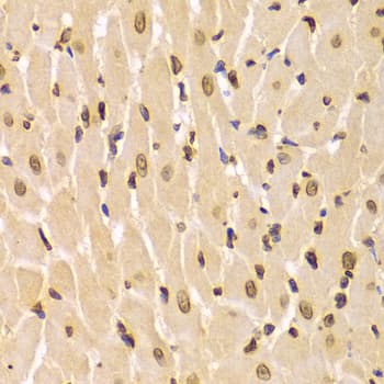 LMNA / Lamin A+C Antibody