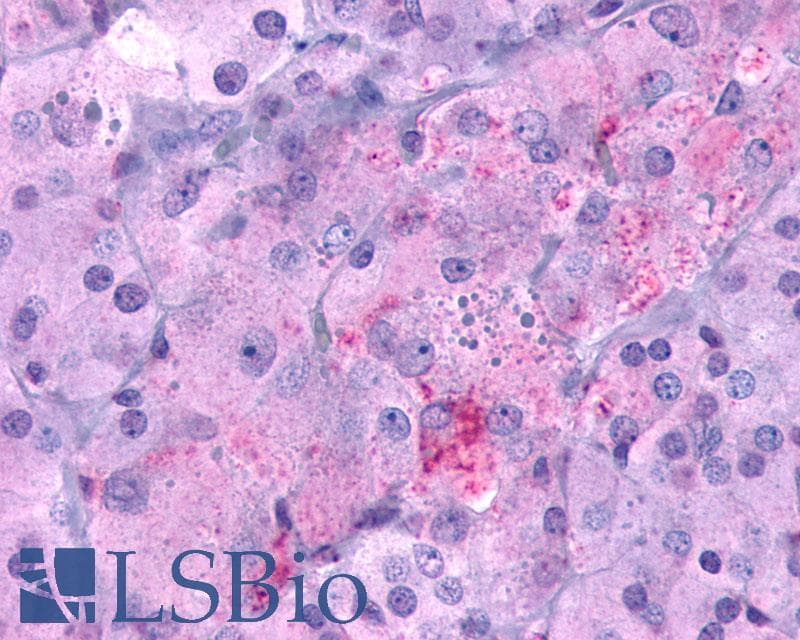 PathPlus™ Polyclonal Rabbit anti-Human GLP1R / GLP-1 Receptor Antibody (N-Terminus, IHC)
