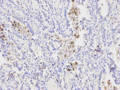 XPA Antibody