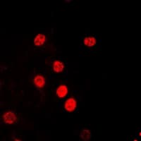 RPA2 / RFA2 / RPA34 Antibody (N-Terminus)