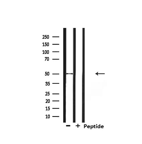 RARB / RAR Beta Antibody