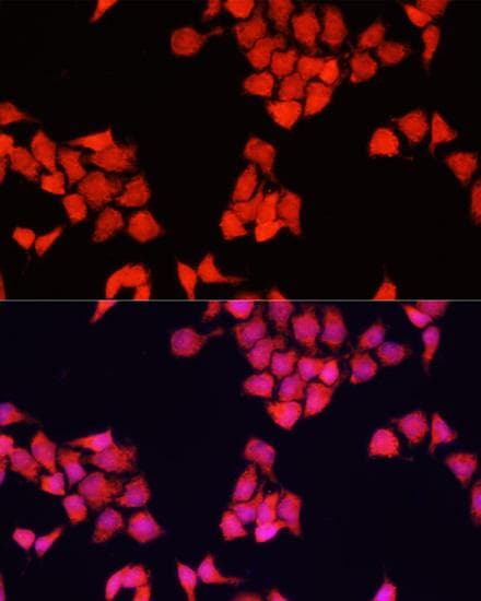 FXR1 Antibody