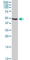 ALDH9A1 Antibody (clone 3C6)