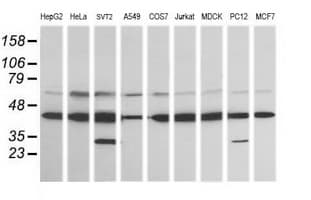 MAP2K1 / MKK1 / MEK1 Antibody (clone OTI7F3)