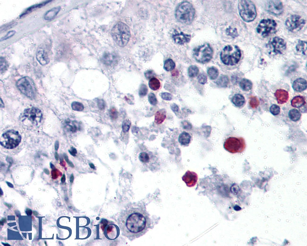 IHC-plus™ Polyclonal Rabbit anti-Human SPANXC / SPANX-C Antibody (IHC, WB)