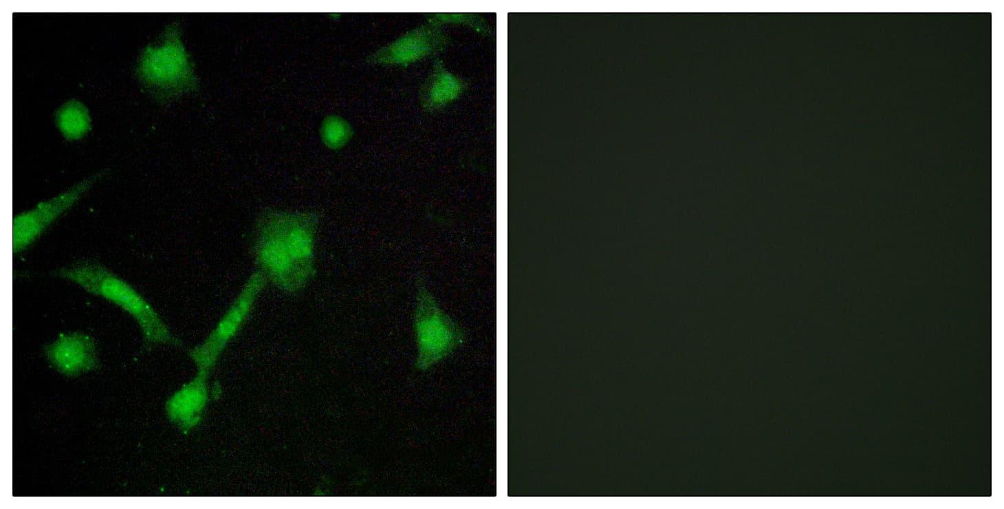 Polyclonal Rabbit anti-Human NFKBIA / IKB Alpha / IKBA Antibody (phospho-Ser32/Ser36, IHC, IF, WB)