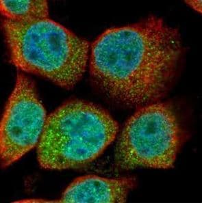 UBB / Ubiquitin B Antibody (aa1-179)