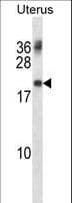 Polyclonal Rabbit anti-Human PMP22 Antibody (aa102-130, WB)