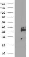 SYP / Synaptophysin Antibody (clone OTI2A10)