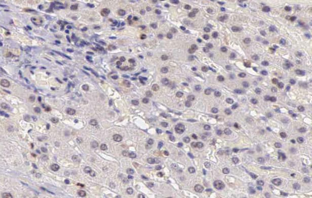 CARD6 Antibody