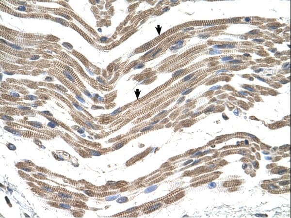 Complement C1QB Antibody (C-Terminus)