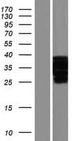 OTUD6A Protein (Over-Expression Lysate Myc-DDK (Flag))
