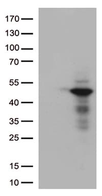 Monoclonal Mouse anti-Human DUSP1 / MKP1 Antibody (clone OTI5A8, WB)