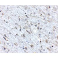Polyclonal Rabbit anti-Human FKBP15 Antibody (IHC, IF, WB)