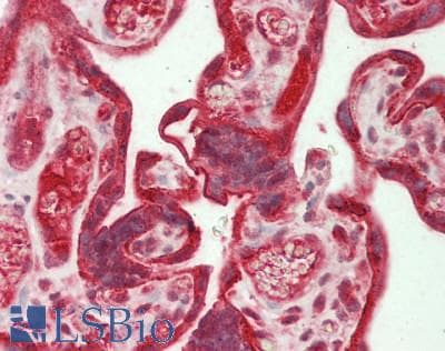 IHC-plus™ Polyclonal Rabbit anti-Human PDGF-BB Antibody (IHC, WB)