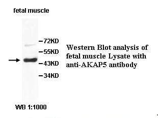 Polyclonal Rabbit anti-Human AKAP5 / AKAP79 Antibody (IHC, WB)