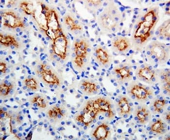 GJB1 / CX32 / Connexin 32 Antibody (aa215-231)