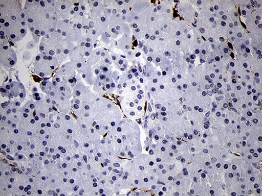 FSCN1 / Fascin Antibody (clone OTI3D2)