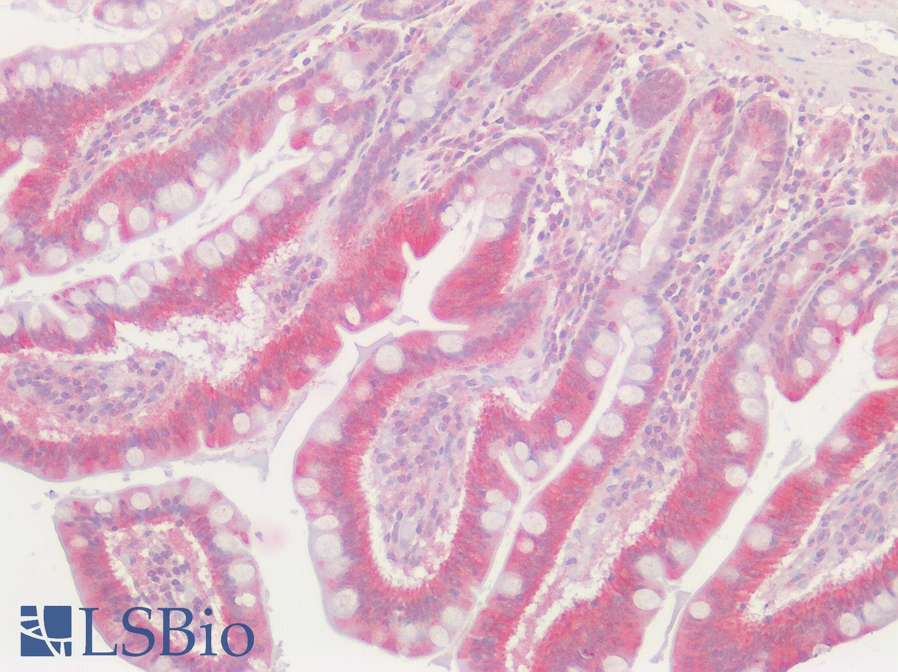 IHC-plus™ GPRC5D Antibody (Cytoplasmic Domain)