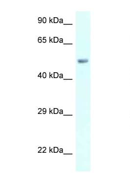 AMY2B Antibody (aa283-332, FITC)