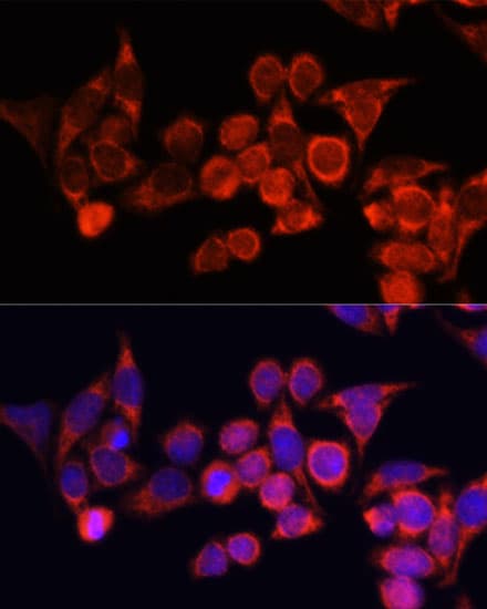 TLR2 Antibody
