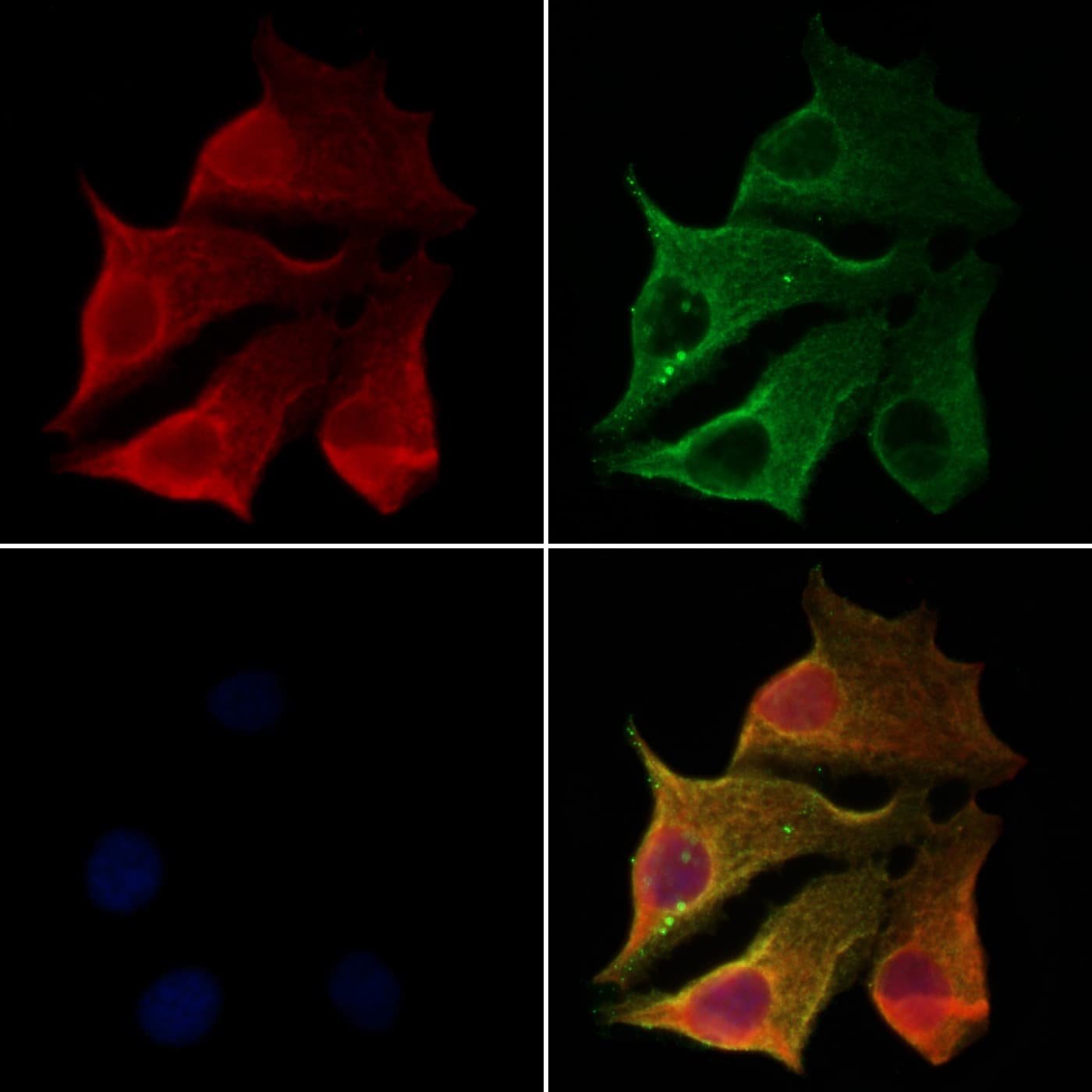 CLTB Antibody