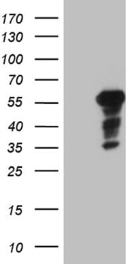 PATZ1 / PATZ Antibody (clone OTI2D2)