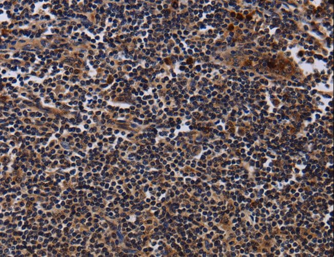 Polyclonal Rabbit anti-Human NTMT1 / C9orf32 Antibody (IHC)