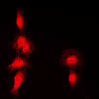 HDAC7 Antibody (N-Terminus)