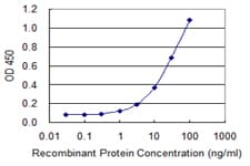 Monoclonal Mouse anti-Human LRAT Antibody (clone 4E12, WB)
