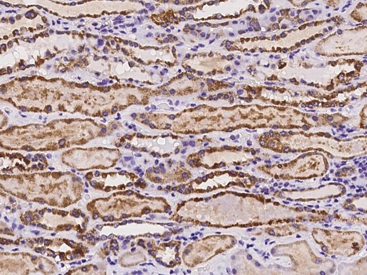 RAB39B Antibody