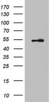 Monoclonal Mouse anti-Human KRT7 / CK7 / Cytokeratin 7 Antibody (clone OTI1B3, IHC, WB)
