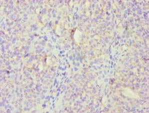 Polyclonal Rabbit anti-Human HBP17 / FGFBP1 Antibody (aa22-232, IHC)