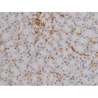 STAT6 Antibody (phospho-Thr645)