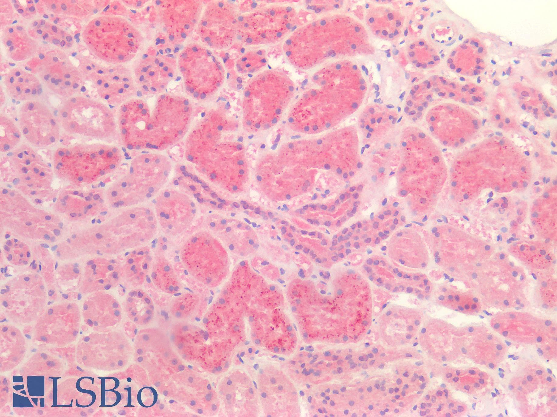 IHC-plus™ TTR / Transthyretin Antibody