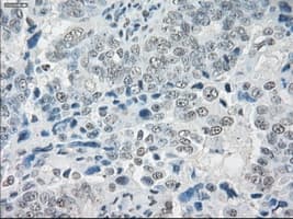 SLC7A8 / LAT2 Antibody (clone OTI7D6)