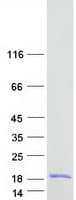 Human SYCE3 Protein (Recombinant Myc-DDK (Flag))