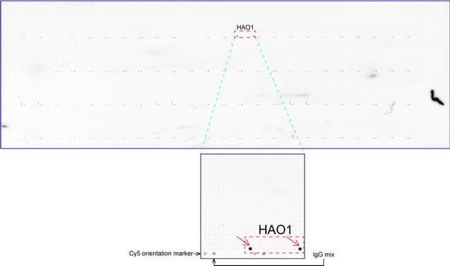 IHC-plus™ HAO1 Antibody (clone UMAB117)