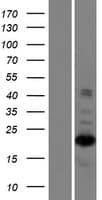 ZNF268 Protein (Over-Expression Lysate Myc-DDK (Flag))