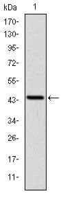 LIMS1 / PINCH Antibody (clone 5G7)