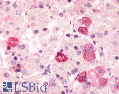 PathPlus™ ADRA2C Antibody (Extracellular Domain)