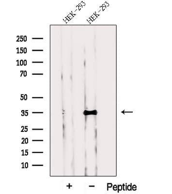 Polyclonal Rabbit anti-Human PPP1CC / PP1 Gamma Antibody (WB)