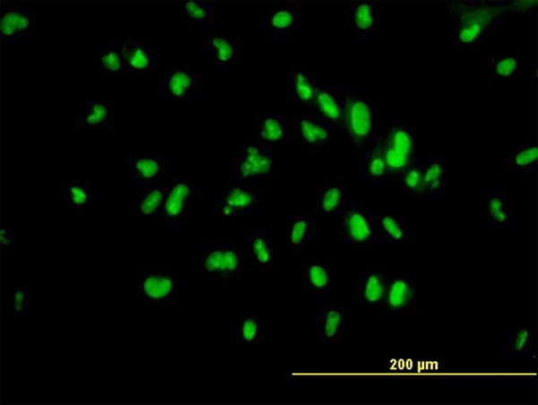 IHC-plus™ UBTF / UBF Antibody (clone 1A2)