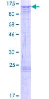 Human NAA25 Protein (Recombinant GST)